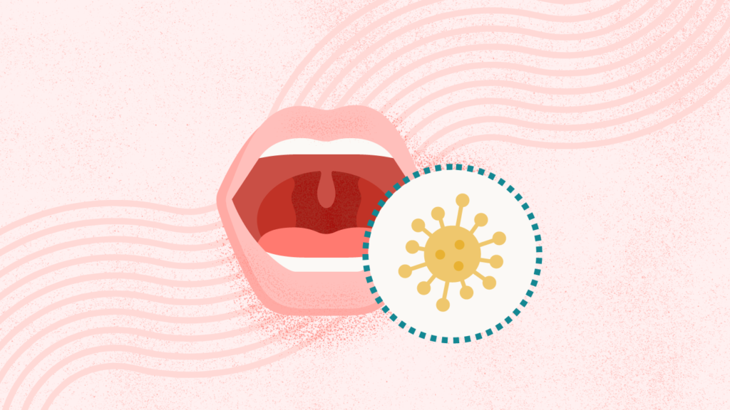 What Is Mononucleosis?