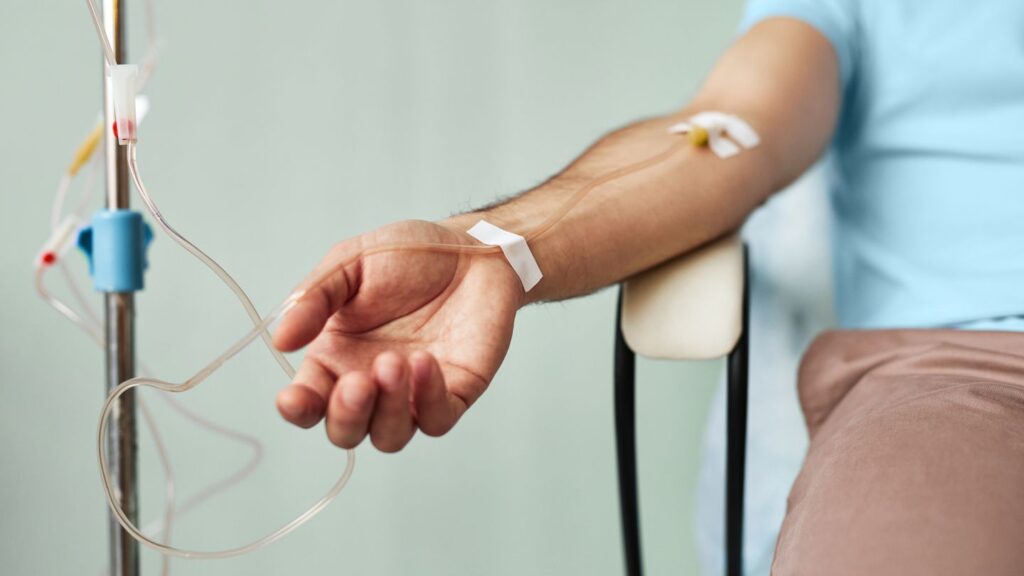 What Does Treatment for ANCA-Associated Vasculitis (AAV) Look Like Today?