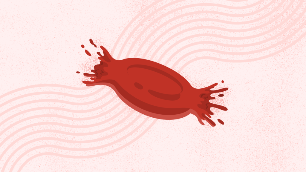 What Is Paroxysmal Nocturnal Hemoglobinuria (PNH)? What Is Paroxysmal Nocturnal Hemoglobinuria (PNH)? Symptoms, Causes, Diagnosis, Treatment, and Prevention