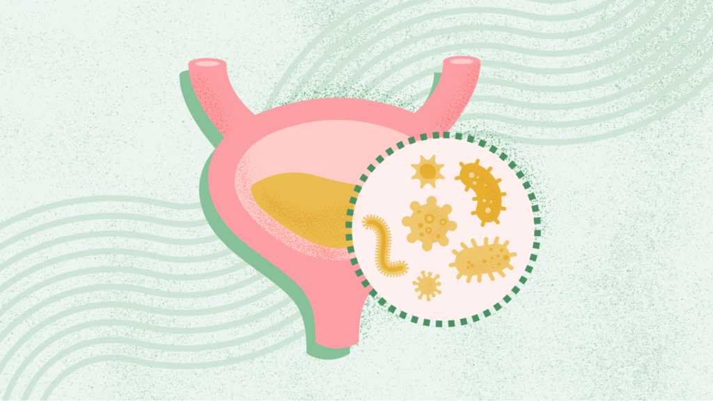 What Is a Urinary Tract Infection (UTI)? Symptoms, Causes, Diagnosis, Treatment, and Prevention What Is a Urinary Tract Infection (UTI)?