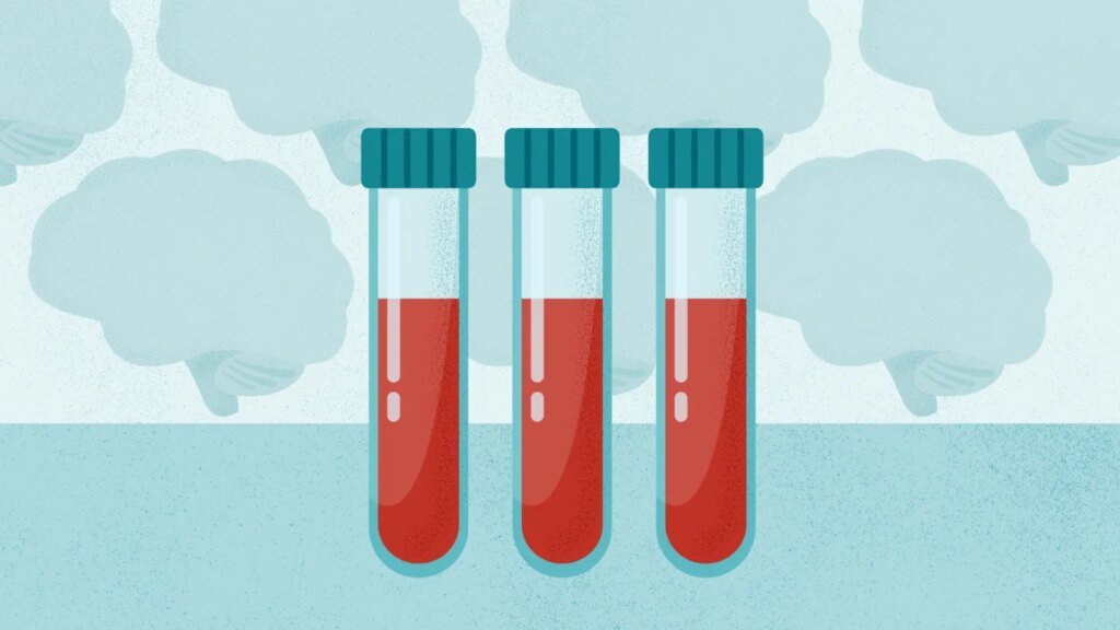 Blood Test May One Day Help Predict Cognitive Decline Before Symptoms Begin