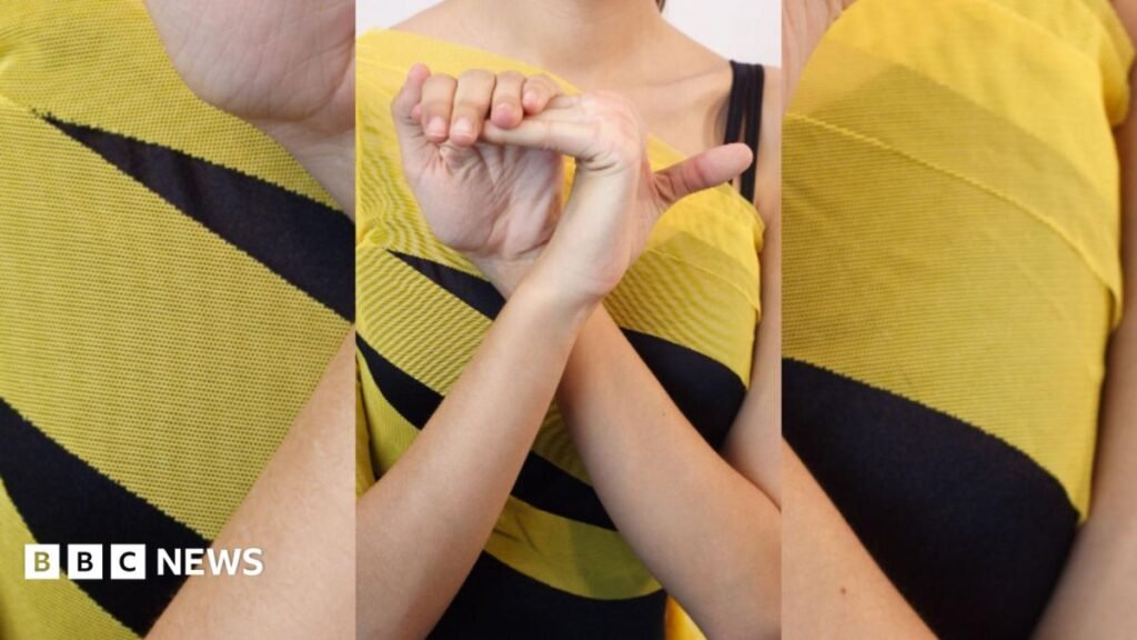 What are the symptoms of Hypermobility Spectrum Disorder? A woman bending the fingers on her right hand back with her left hand. She is wearing a yellow and clock top.