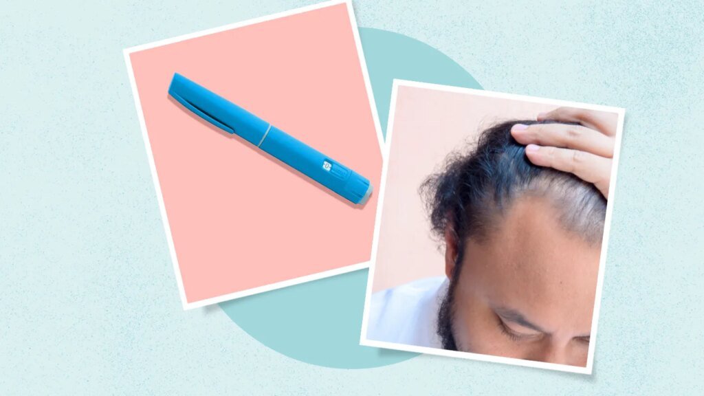Do GLP-1s Cause Hair Loss? What to Know and What You Can Do